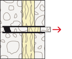 Wetterschalen-Saniersystem FWS II | fischer